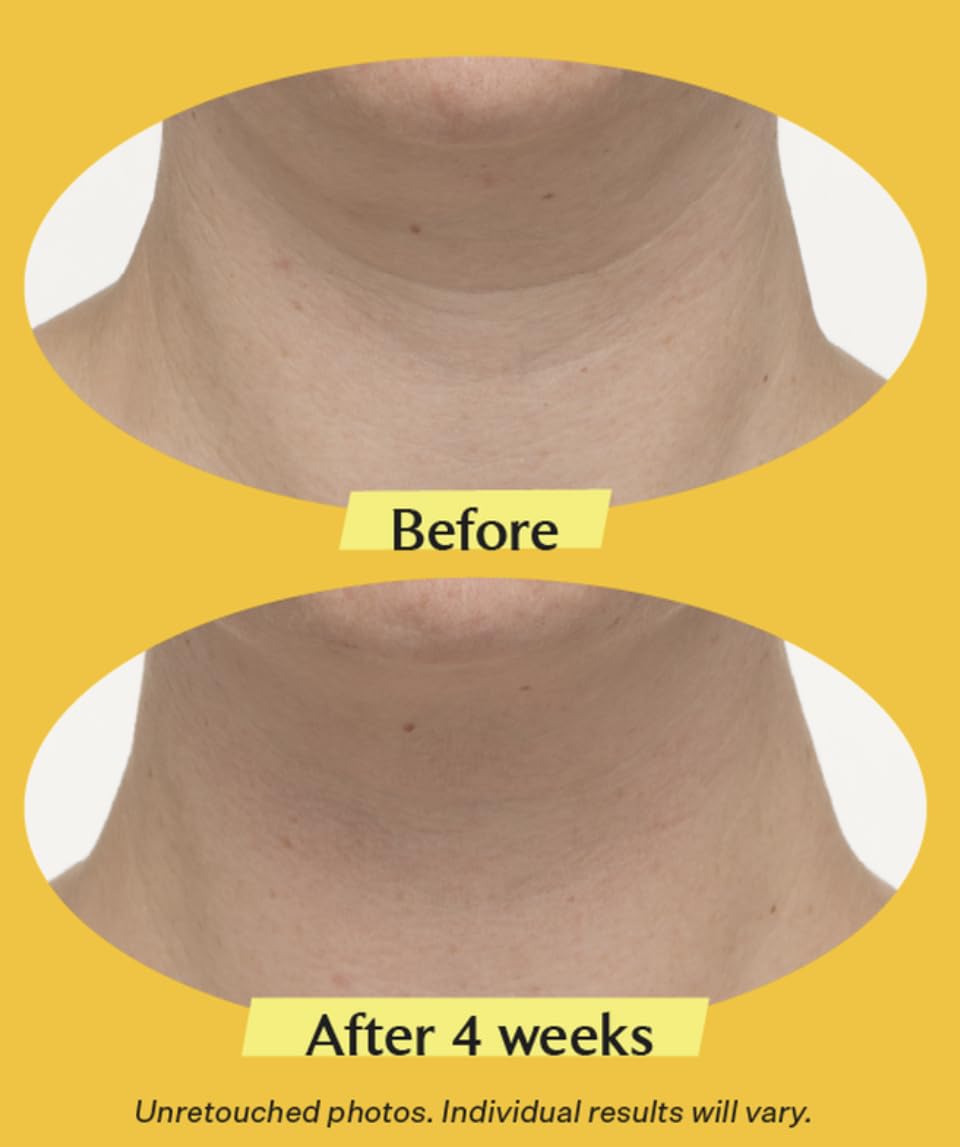 StriVectin Neck Cream 2 pack