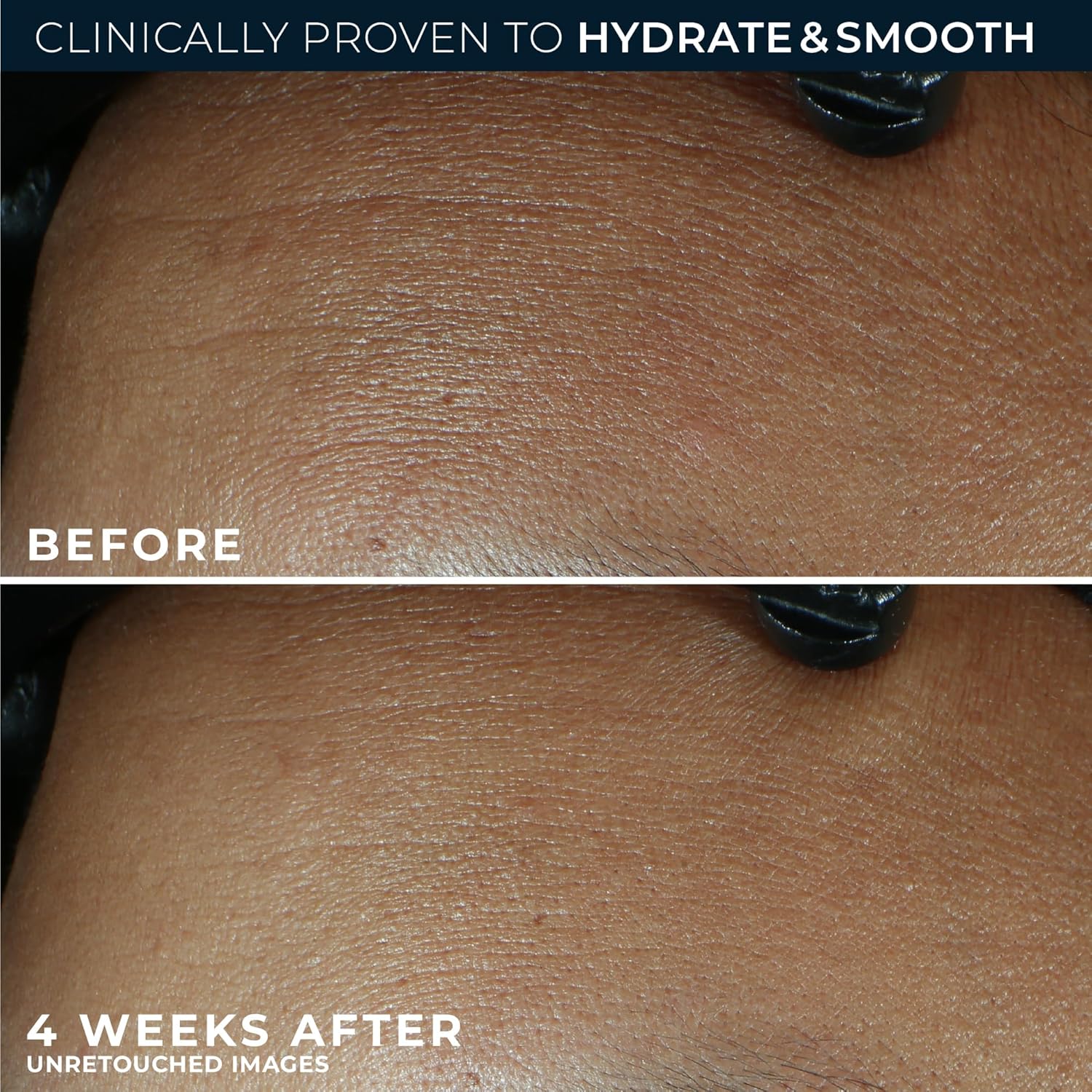 RoC Hyaluronic Face Moisturizer
