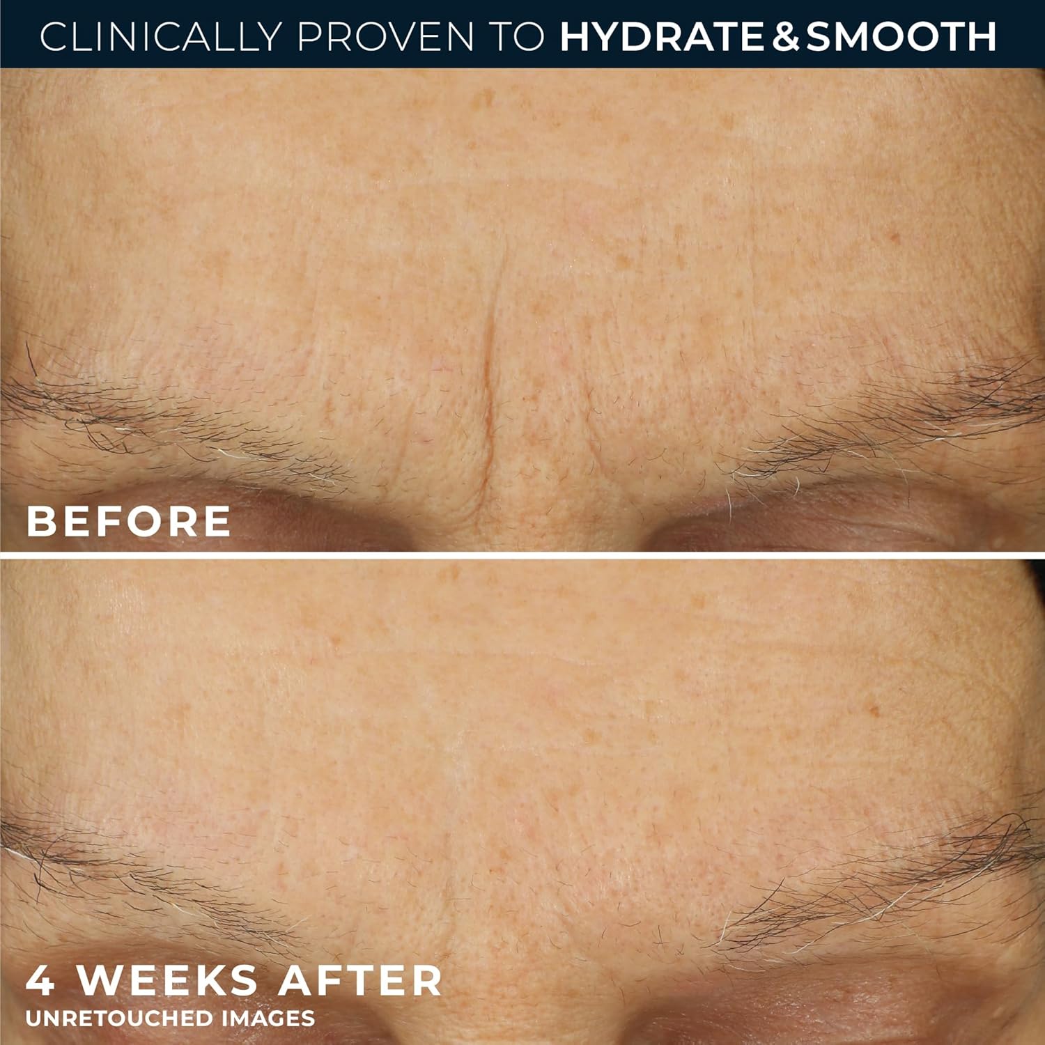 RoC Hyaluronic Face Moisturizer